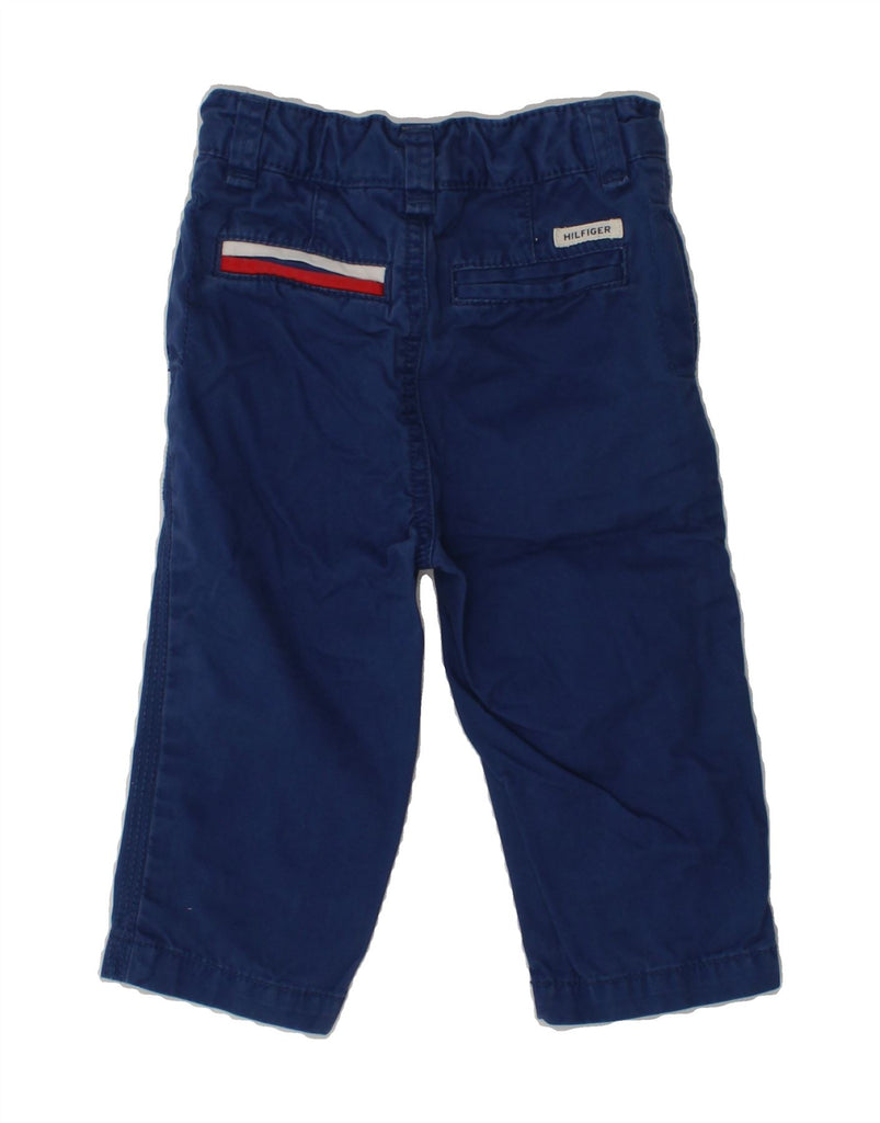 TOMMY HILFIGER Baby Boys Straight Chino Shorts 9-12 Months W16 L9  Blue | Vintage Tommy Hilfiger | Thrift | Second-Hand Tommy Hilfiger | Used Clothing | Messina Hembry 